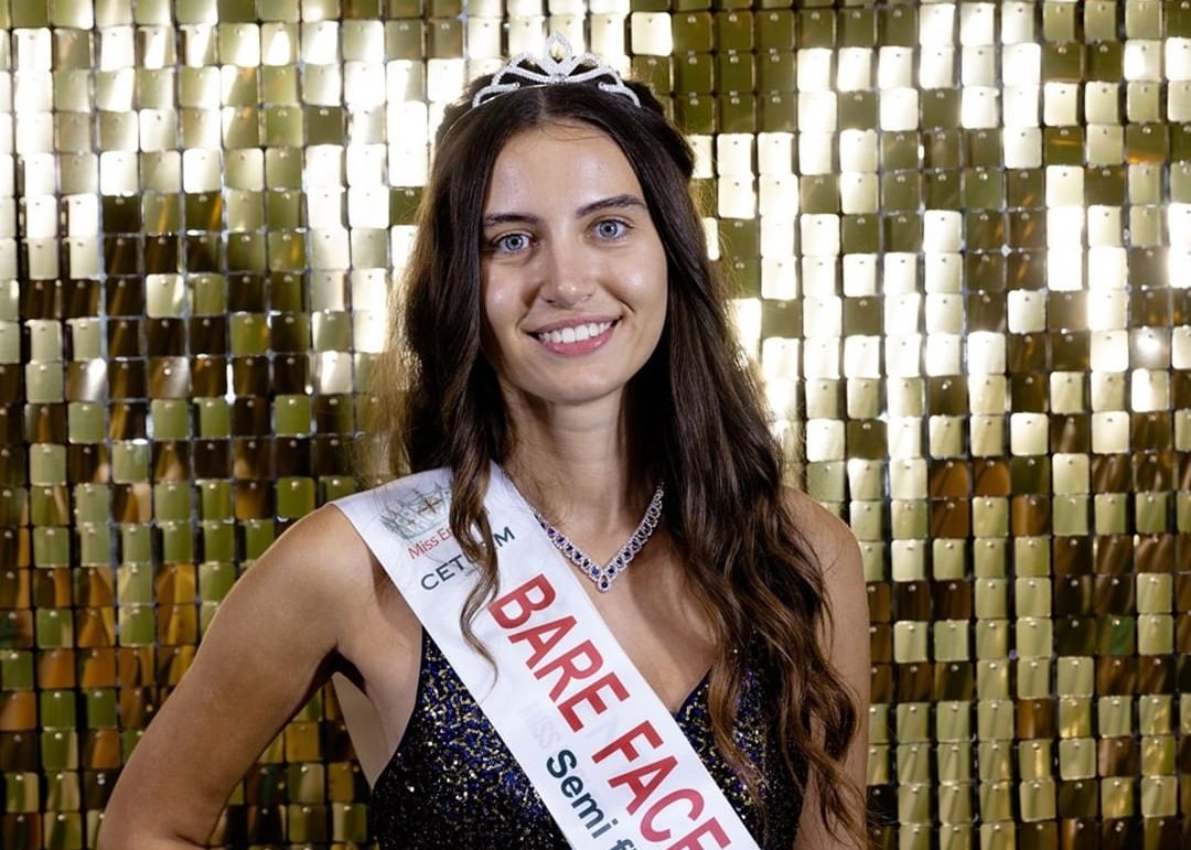 The first queen to compete without makeup and is a finalist.