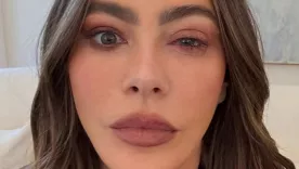 Sofía Vergara sufrió una reacción alérgica en sus ojos