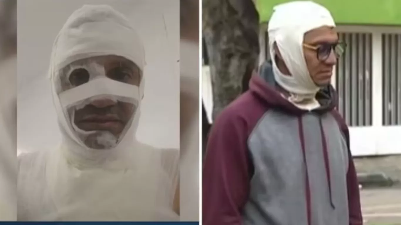 Hombre atacado con ácido en Bogotá