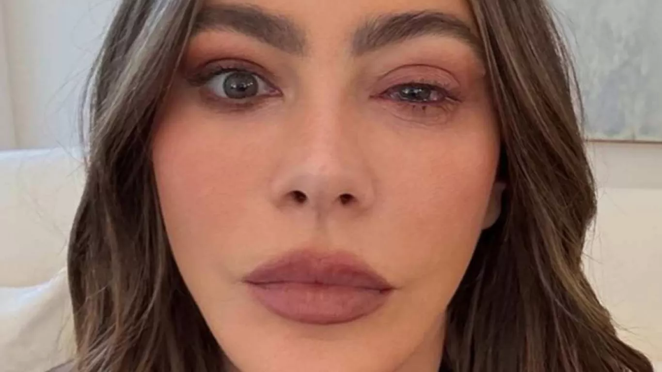 Sofía Vergara sufrió una reacción alérgica en sus ojos